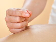 Schmerztherapie mit Akupunktur und TCM in München